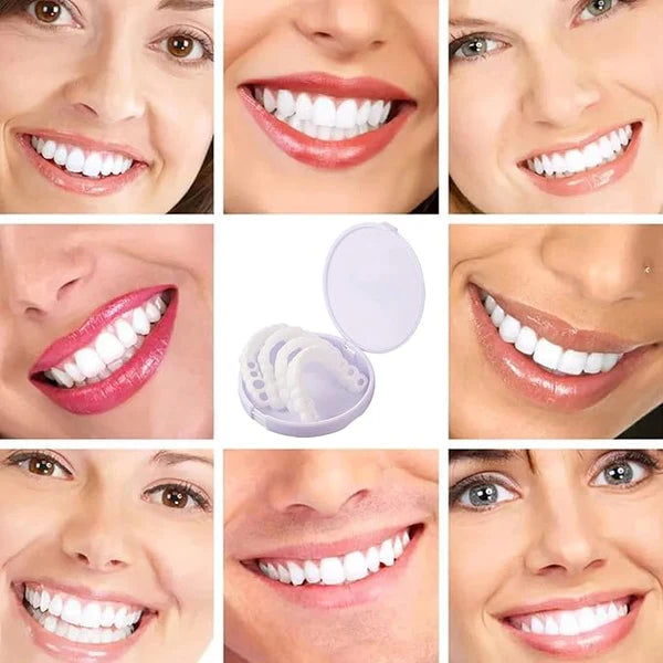 Carillas Dentales Snapon Smile - Paga Al Recibir