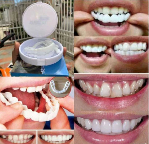 Carillas Dentales Snapon Smile - Paga Al Recibir