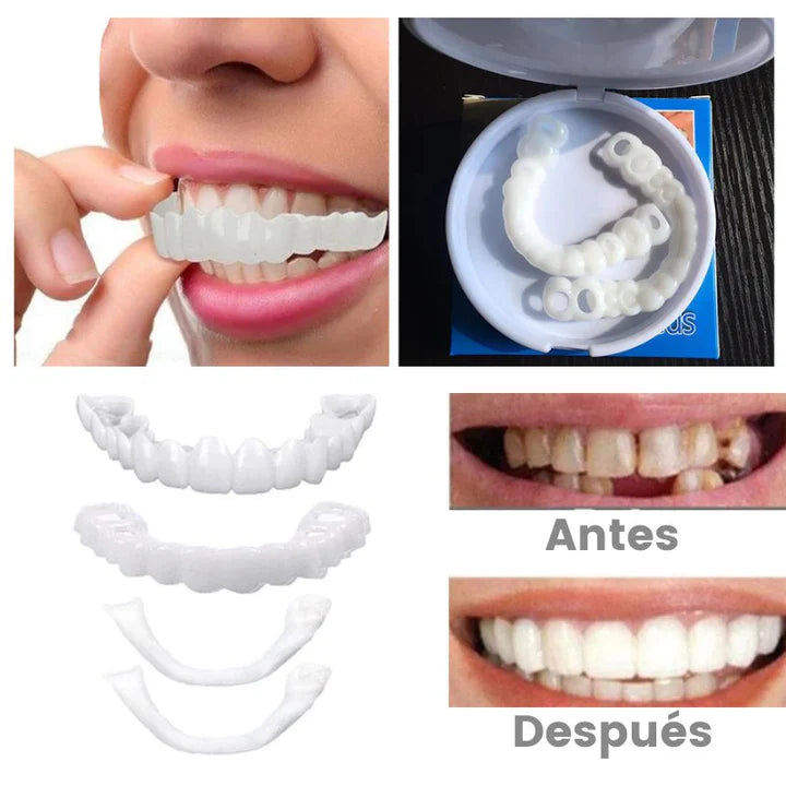 Carillas Dentales Snapon Smile - Paga Al Recibir